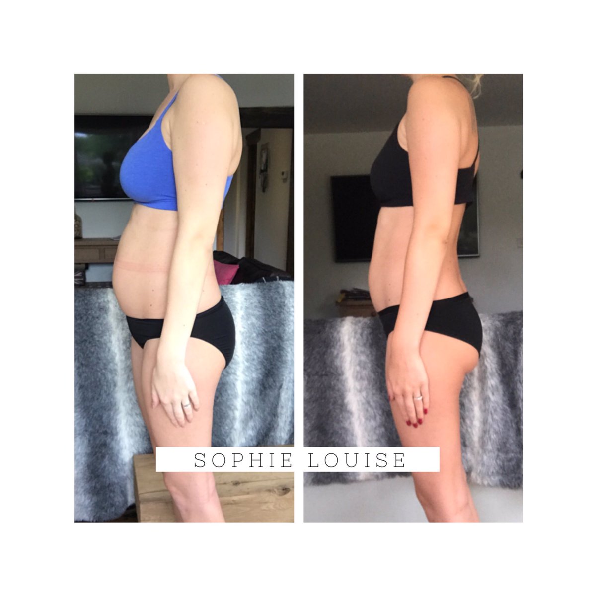 sophielouisetnn's tweet photo. On the left I am 9 weeks post partum, and on the right am 17 weeks post partum 👇🏼 2 stone down on the #ELITEplan and I am feeling great 🔥 https://t.co/seoFOqwuJq