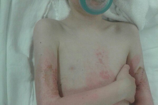 MistickFarm's tweet image. Please support my GoFundMe campaign: gofundme.com/brodericks-bur… @gofundme no one ever wants this to happen