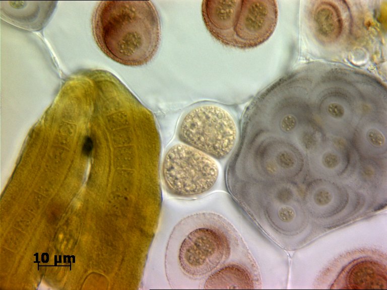 nqgood's tweet photo. #Cyanobacteria #Chroococcus #RussianLapland https://t.co/lgTI0i3Ajz