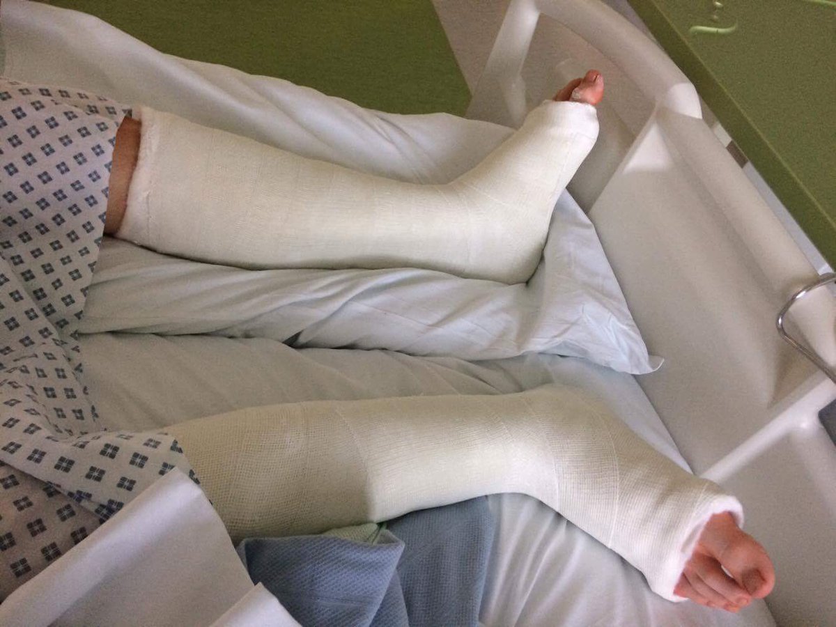 teddy_challenge's tweet photo. @MissDLloyd @dmb1302 @WidnesRotary @MerseyHack @CllrAndreaWall surgery #schoolholidays #surgerycomplete now plans for next fundraiser begin https://t.co/73PUrSsA0D
