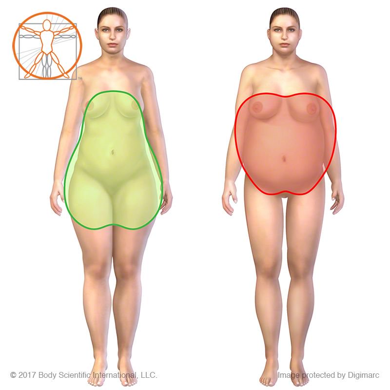 bodyscientific's tweet photo. Apple vs Pear body shape All images © BSI #medicalillustration  #medicalart #healthandwellness #weight #applebodytype #pearbodytype https://t.co/3c26YxtnXn