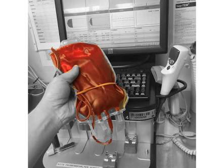 haemoview's tweet image. Change of transfusion and treatment paradigm in major trauma patients #Goaldirected#ROTEM ncbi.nlm.nih.gov/pubmed/28542848