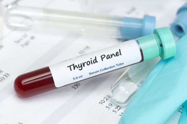 endocrineweb's tweet photo. Substantial Variability Persists in #Thyroid Function Tests https://t.co/8zFljep7HA #FOAMed https://t.co/SrZanv2yHd