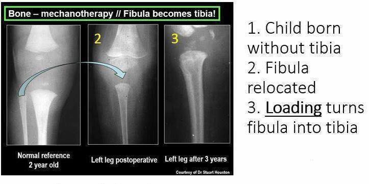 This is awesome! It always amazes me how our bodies can adapt!