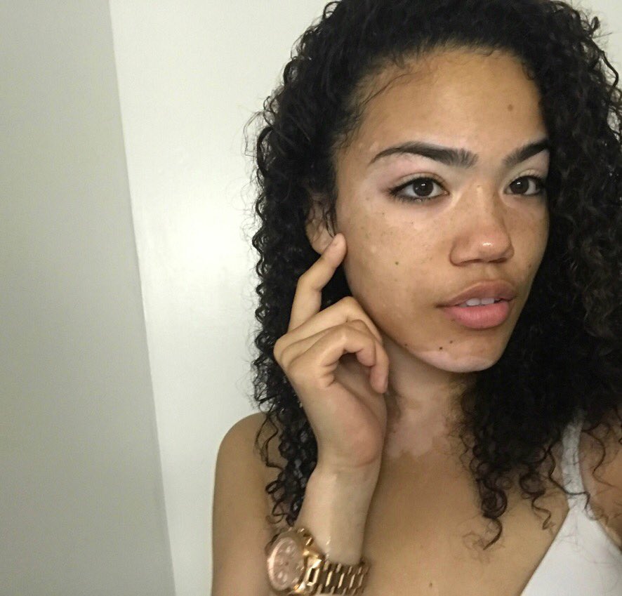 Jxrdvnquinn's tweet photo. No filter, no makeup https://t.co/nhOlTiu5MJ