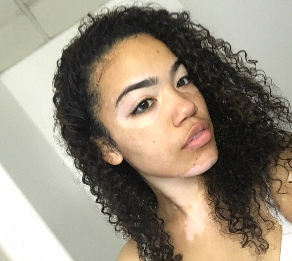 Jxrdvnquinn's tweet photo. No filter, no makeup https://t.co/nhOlTiu5MJ