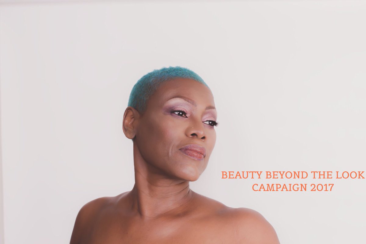 DardenMiles's tweet photo. #lupusbeauty https://t.co/Ni9mmJEhtD