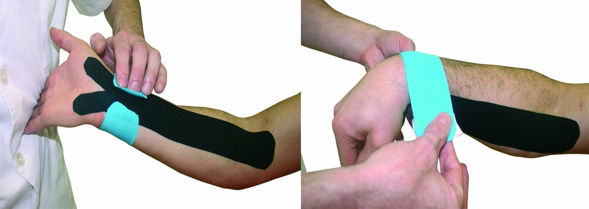 biolaster1's tweet photo. Aplicación de #VendajeNeuromuscular para el Tratamiento del Túnel Carpiano #Kinesiotaping #Temtex
https://t.co/3cWbmtqi6L https://t.co/05GQePZjdL