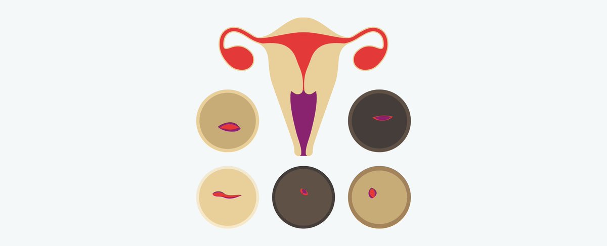 OvaWoman's tweet photo. Do you know *where* your cervix is? How to find (and feel) your cervix:  https://t.co/VvsdBecbOK https://t.co/HtT6FLOlte