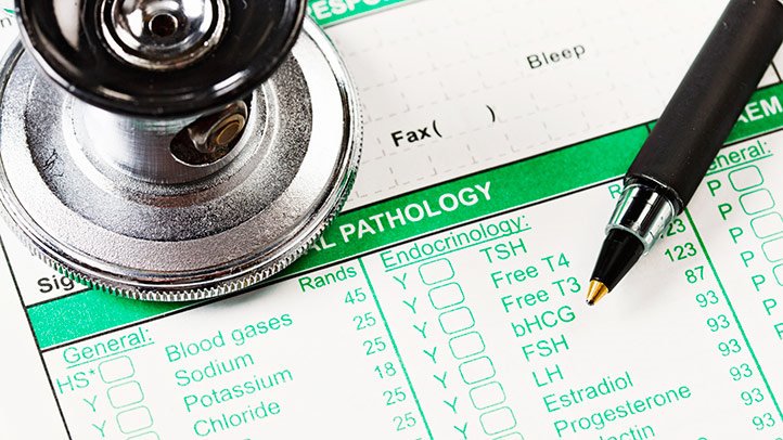 keephealthysite's tweet photo. #hypothyroidismTestResults #tshlevel #tshlevels #thyroidtest #TSH Understanding Your Hypothyroidism Test Results- https://t.co/sHhanyHEid https://t.co/G5bdzSl3tj