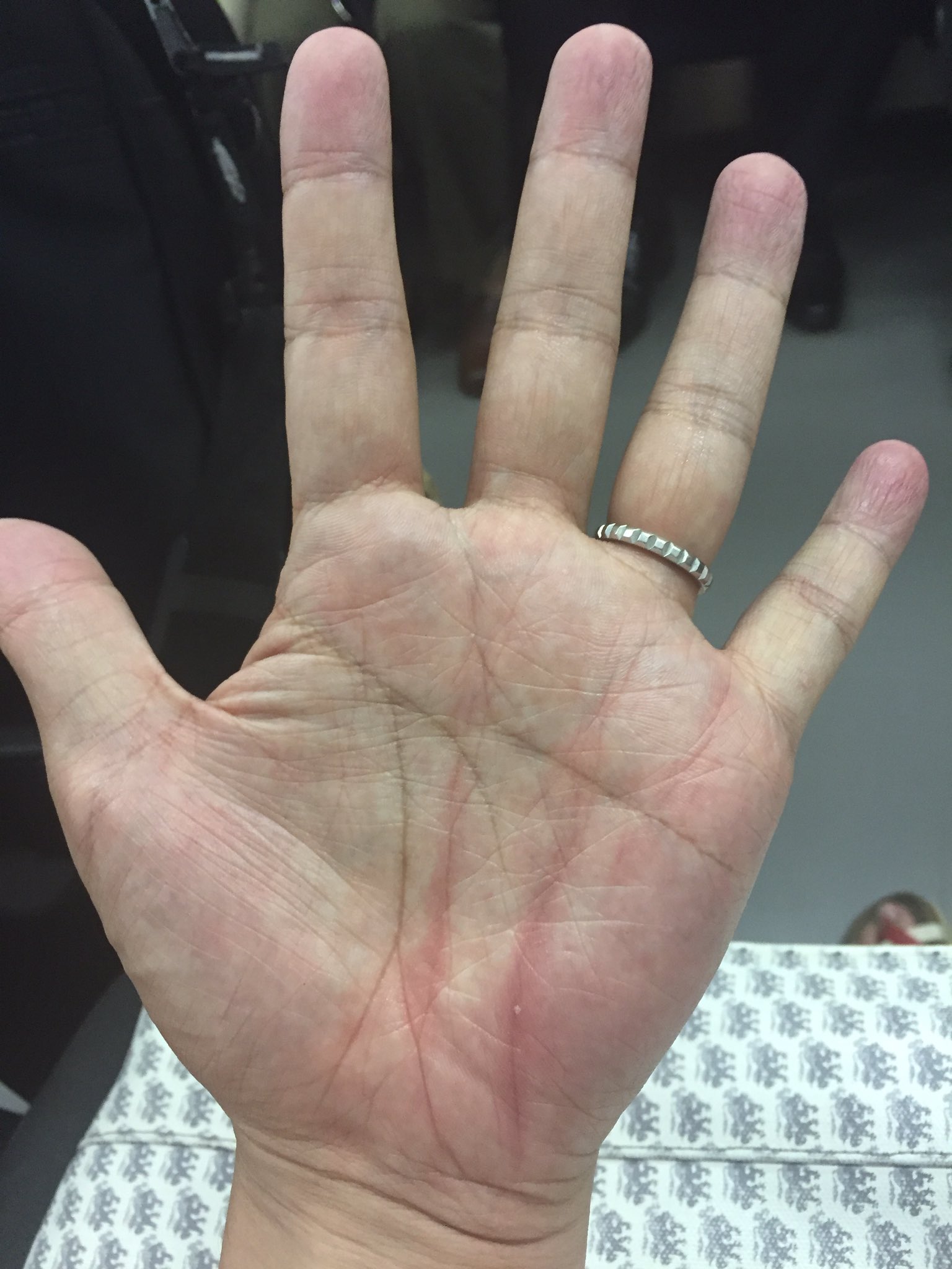 Ryota Kanai 金井 良太 なんか手相が変 謎の縦線が出て来たけどなんだ T Co Fqnx2wsto9 Twitter