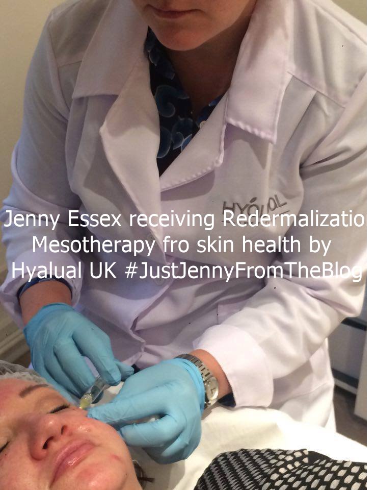 JustJennyEssex's tweet photo. #Redermalization Contact me4details of products4skin health #Meso #Needling just.jenny1@hotmail.co.uk #SuccincAcid @Ticktoxdetox @HyalualUK https://t.co/SNPrlS2lqA