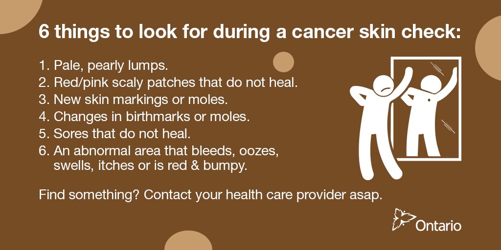 ONThealth's tweet photo. Have you checked your #skin lately? It might be time for a skin check. Here is what to look for. https://t.co/n52BxJaiEf
#skincancer https://t.co/2vaIlabQfF