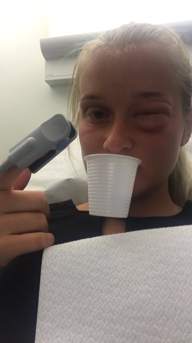 Varma öl och kalla element tweet media