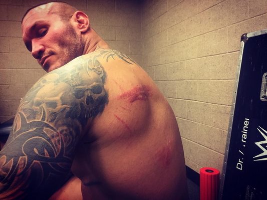 UfcNews4's tweet photo. [PHOTO] The back of Randy Orton after his defeat at Battleground.
https://t.co/vmzeRz62ik https://t.co/MBlPog98Re