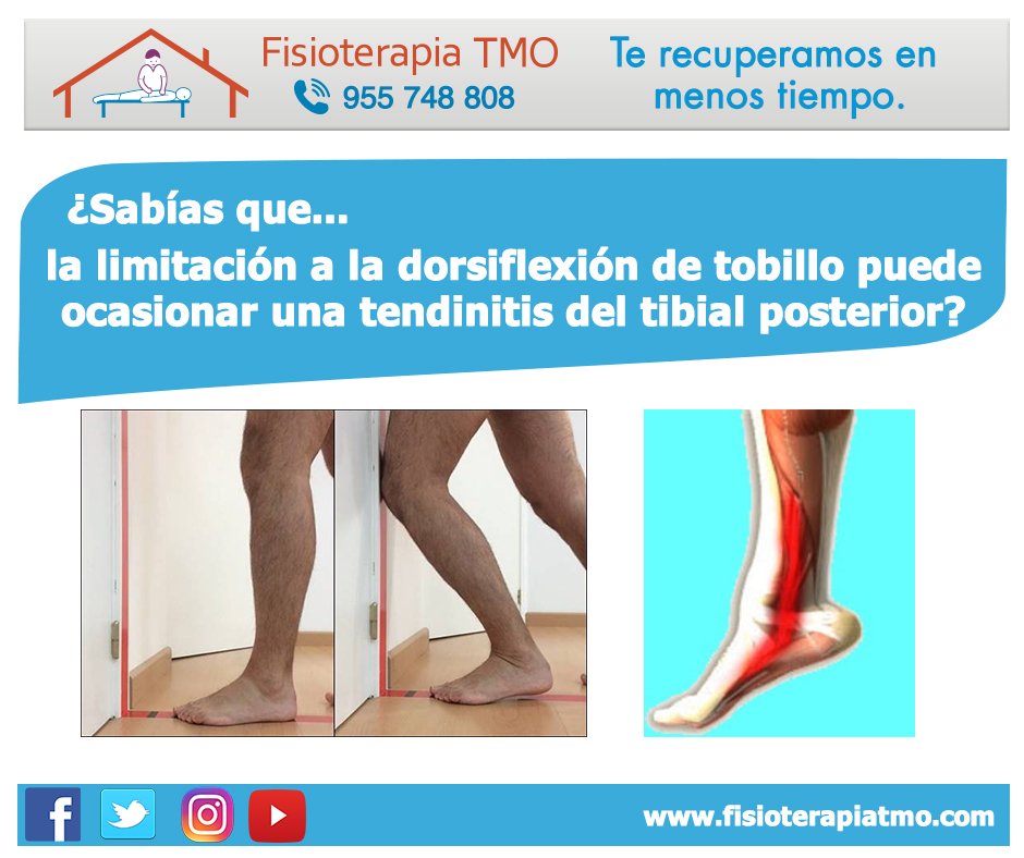 fisioterapiaTMO's tweet photo. #Flexibilidad #limitada de #tobillo produce que el pie gire más ocasionando #mayor #fricción del tendón del tibial posterior #YoElegiCorrer https://t.co/Ob6hl1M0lo