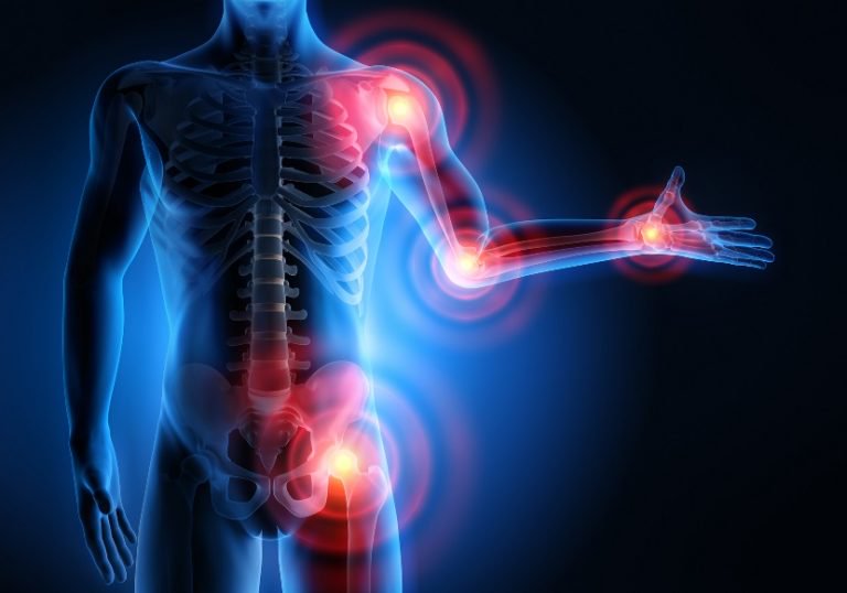 AlignYourHealth's tweet photo. Joint swelling can restrict your mobility and range of motion. Call (623) 229-6193 for more information.
https://t.co/HZZmIg4g1N
#PainRelief https://t.co/0aJ56CKp6g