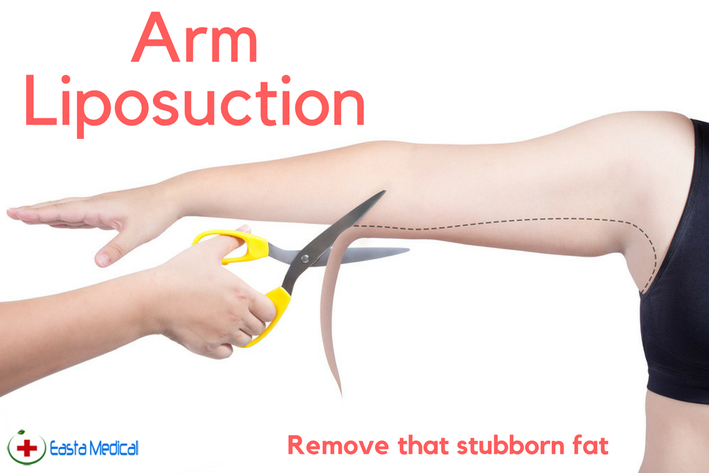 eastamedical's tweet photo. Tweet Remove fat from your arms fast and safely without hard workouts.
  Read more: https://t.co/r3rmjl54xK https://t.co/p5giAs5yyY