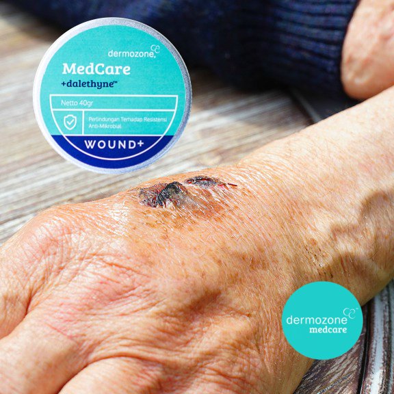 dermozone's tweet photo. Among other benefits, + dalethyne™ its ingredients contains anti-inflammatory, used to kills germs, removes unpleasant odors on wounds. https://t.co/U9gsRxPkaB