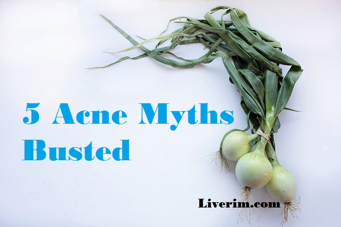 Liverimdotcom's tweet photo. Top 5 #Acne Myths Busted that You Should Know!
https://t.co/GaQ9GQbMPE
#pimple #skin #skincare #skincaretips #beauty #natural #acnecontrol https://t.co/nurkHpEuB9