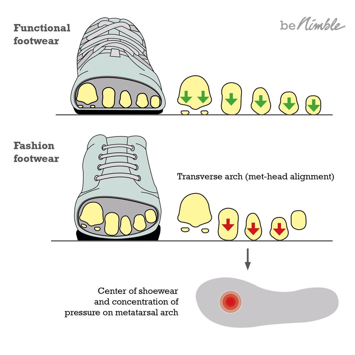 CoachLeeSaxby's tweet photo. Being nimble requires fully functional feet, don't be a fashion victim #benimble #functionalfootwear https://t.co/JWlrd9hMad