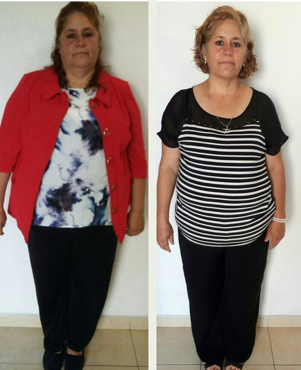 forrestrunteam's tweet photo. #MilKiloMenosParaDurango ##ProgramaQueCambiaVidas me siento felíz por los cambios generados en mis pacientes 26 kgs menos y una deportista + https://t.co/rB3kSwGQHS