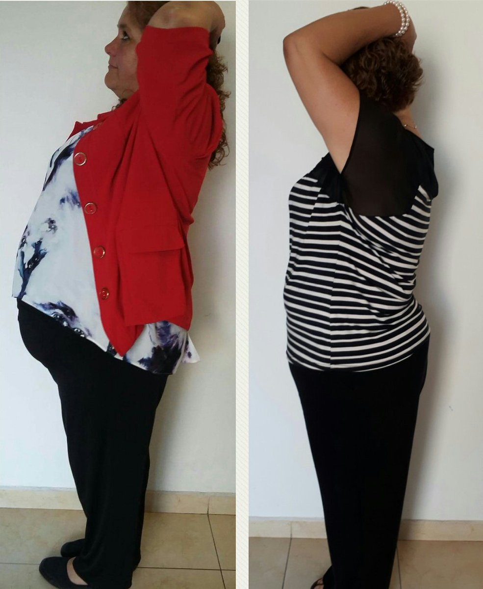 forrestrunteam's tweet photo. #MilKiloMenosParaDurango ##ProgramaQueCambiaVidas me siento felíz por los cambios generados en mis pacientes 26 kgs menos y una deportista + https://t.co/rB3kSwGQHS