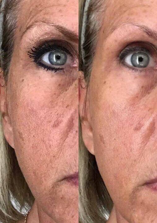 ReflectUYouth's tweet image. An innovative delivery of the freshest #VitaminC your skin has ever experienced!
I can help you with your #discolorations &amp;amp; #brightness