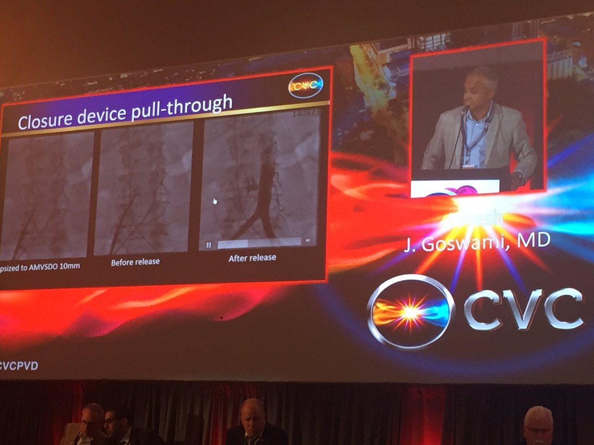 cvcpvd's tweet image. Managing complications of #transcaval access @cvcpvd session with Dr Goswami and @AdamGreenbaumMD