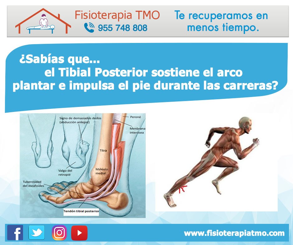 fisioterapiaTMO's tweet photo. La debilidad del #TibialPosterior ocasiona una #Friccion del tendón con el hueso generando una inflamacion en la #BordeInternoDelPie https://t.co/kaMI1Mz82A