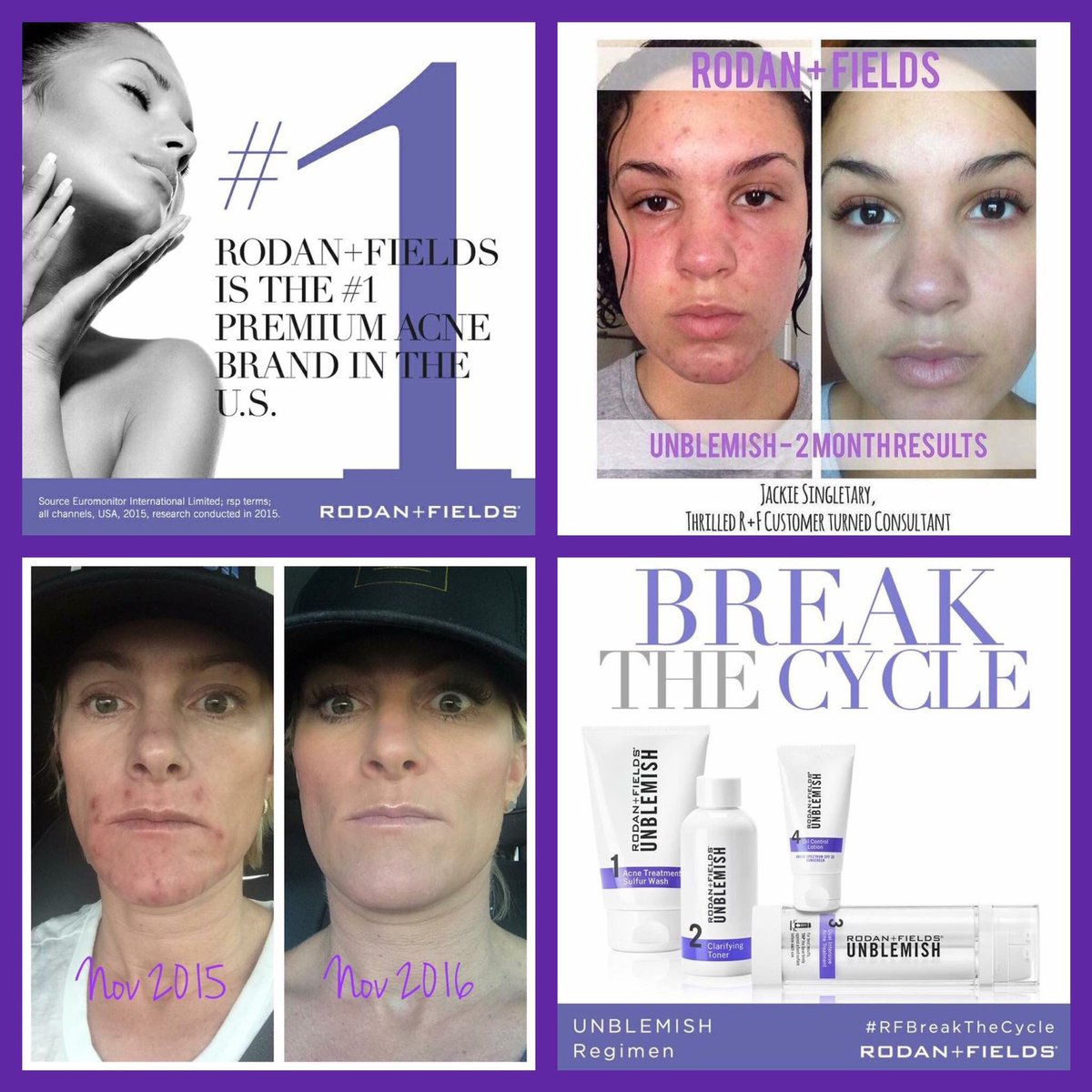 PKidsDirectory's tweet photo. Goodbye Acne!                                          
Love the Skin you're In Visit:https://t.co/1ppzTkqCuV https://t.co/O2zJf8jXbP