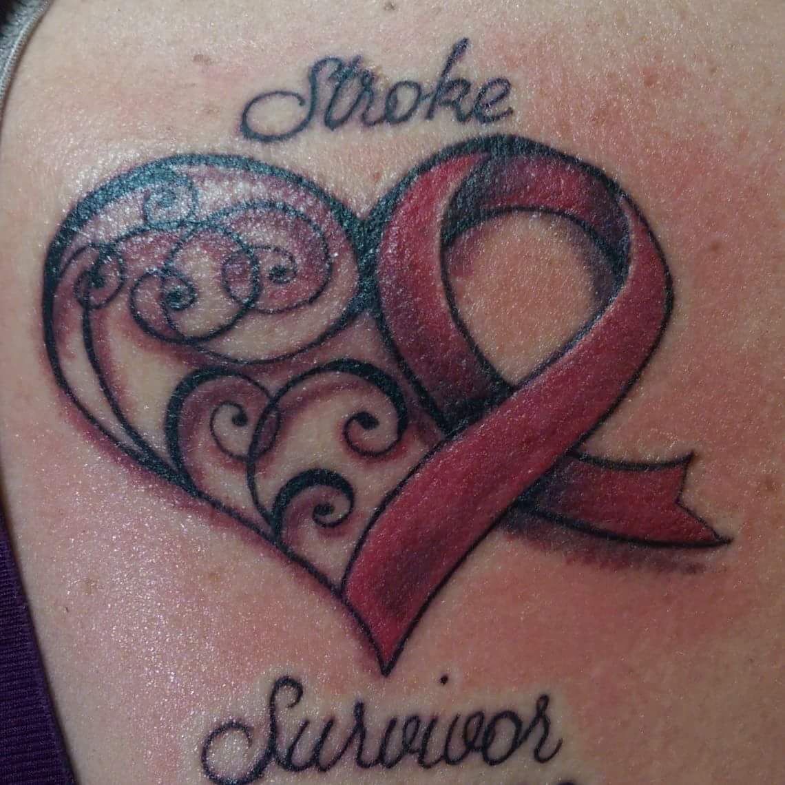 29 years today a Stroke survivor. 