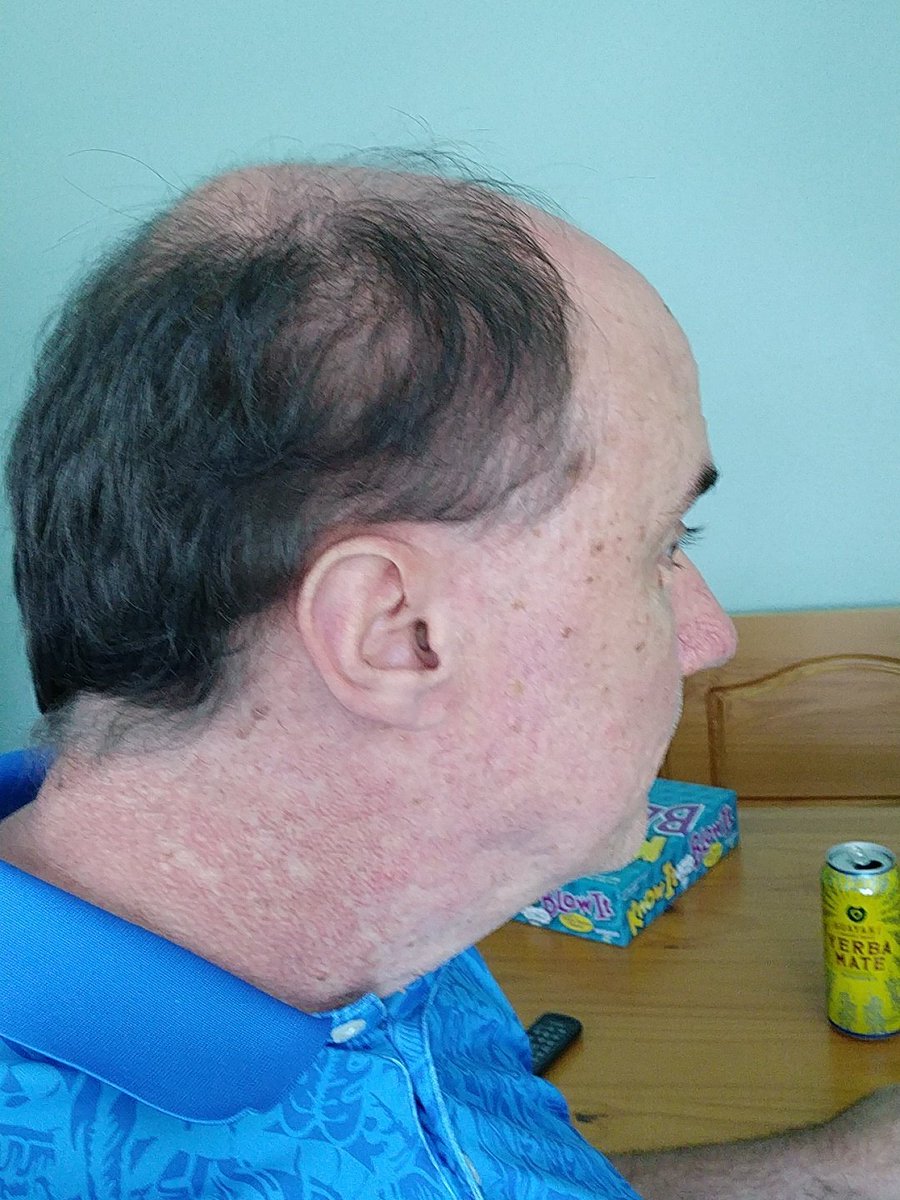 Epicreviewguys V Twitter One Week After Stopping Control Gx Grey Reducing Shampoo Is The Color Starting To Wash Out Controlgx Jfm Justformen Greyhair Https T Co Yncleschnc Twitter