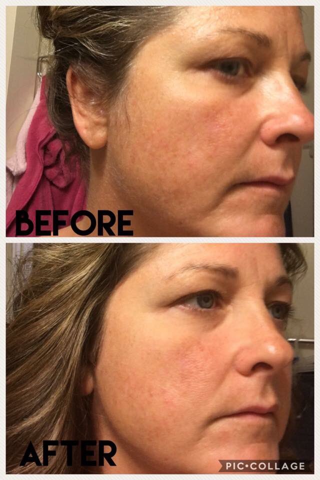 Kellyschoep's tweet photo. Two days of using our new illumaboost serum! #neriumnext I have samples! https://t.co/luwYimm7uK