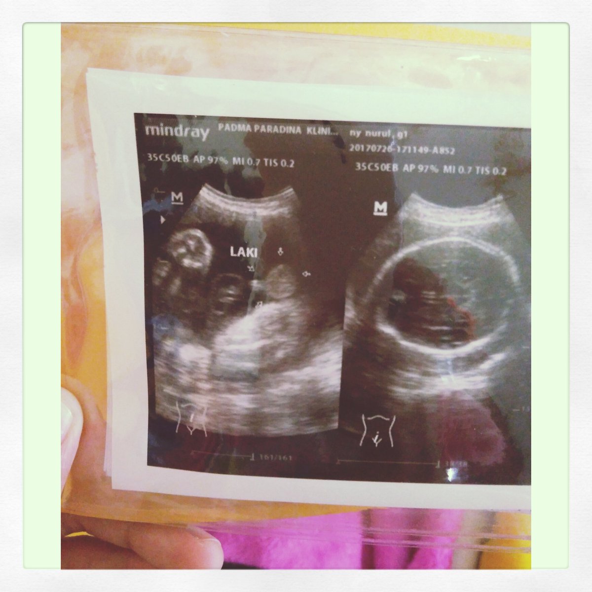 inayyyyy's tweet photo. It's a baby boy 👶 #30weekspregnant https://t.co/3lQktPpcWS
