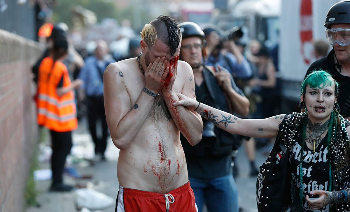 g20_doku's tweet image. Crowdsourcing: Gibt es mehr Informationen/Kontext zum Fall &quot;Pfefferspray vs. küssenden Punk&quot;? #polizeigewalt g20-doku.org/2017/07/07/pfe…