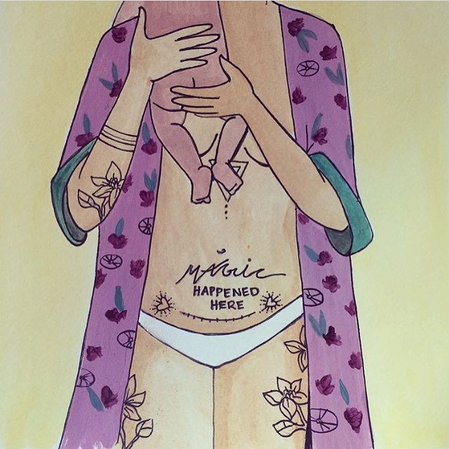 OvaWoman's tweet photo. On the #OvaWoman blog, one mom shares her experience giving #birth 2x via #csection. 👉 https://t.co/aCxIeFgELK https://t.co/EkTbL8dyQa