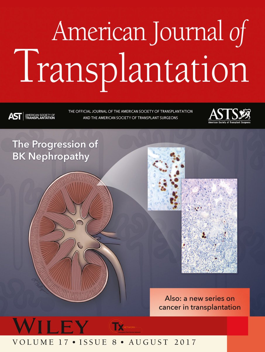 Resultado de imagen para american journal of transplantation