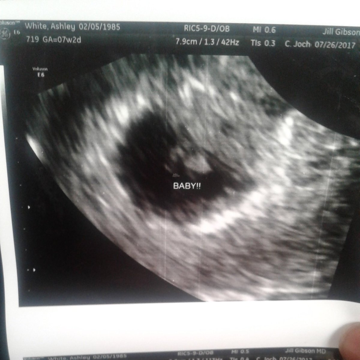 sayno_2Lames's tweet photo. Look who Is expecting. Of course you see It says Ashley White and of course her husband Gerald Whittington.
#GodMomma https://t.co/vswtknlXra