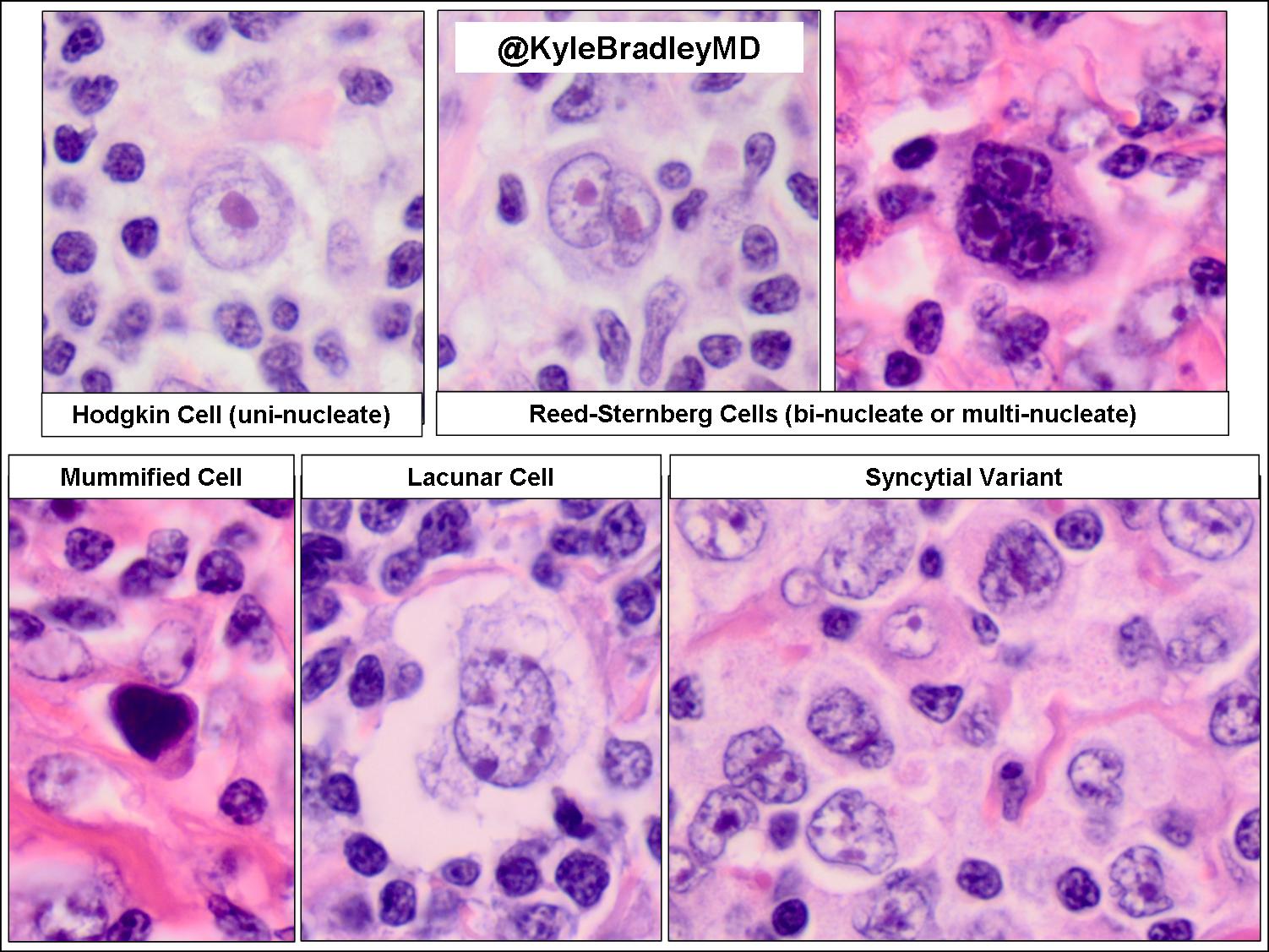 Zeliha CelenSimsek, MD (ZelihaCelenmd) / Twitter
