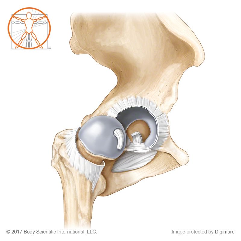 bodyscientific's tweet photo. Hip joint
All images © Body Scientific International. #medicalillustration #sciart #anatomyart #hip #hipjoint #hipsocket #pelvis https://t.co/qSmOj1P5Ta