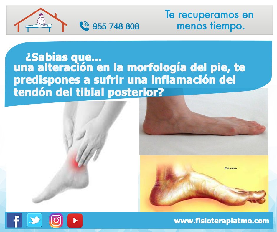 fisioterapiaTMO's tweet photo. Si corres y posees #PiePlano o #PieCavo, tienes gran riego de sufrir una #inflamación del #tendón del #tibialposterior  #YoElegiCorrer https://t.co/KduxkZj0Fg