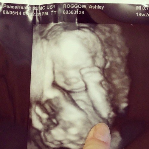 ❛ ʙᴀʙʏ scᴀɴ
— ᴘᴀʀᴛ 1
       &amp;
— ᴘᴀʀᴛ 2. ❜

— @SaviourOfQueens.