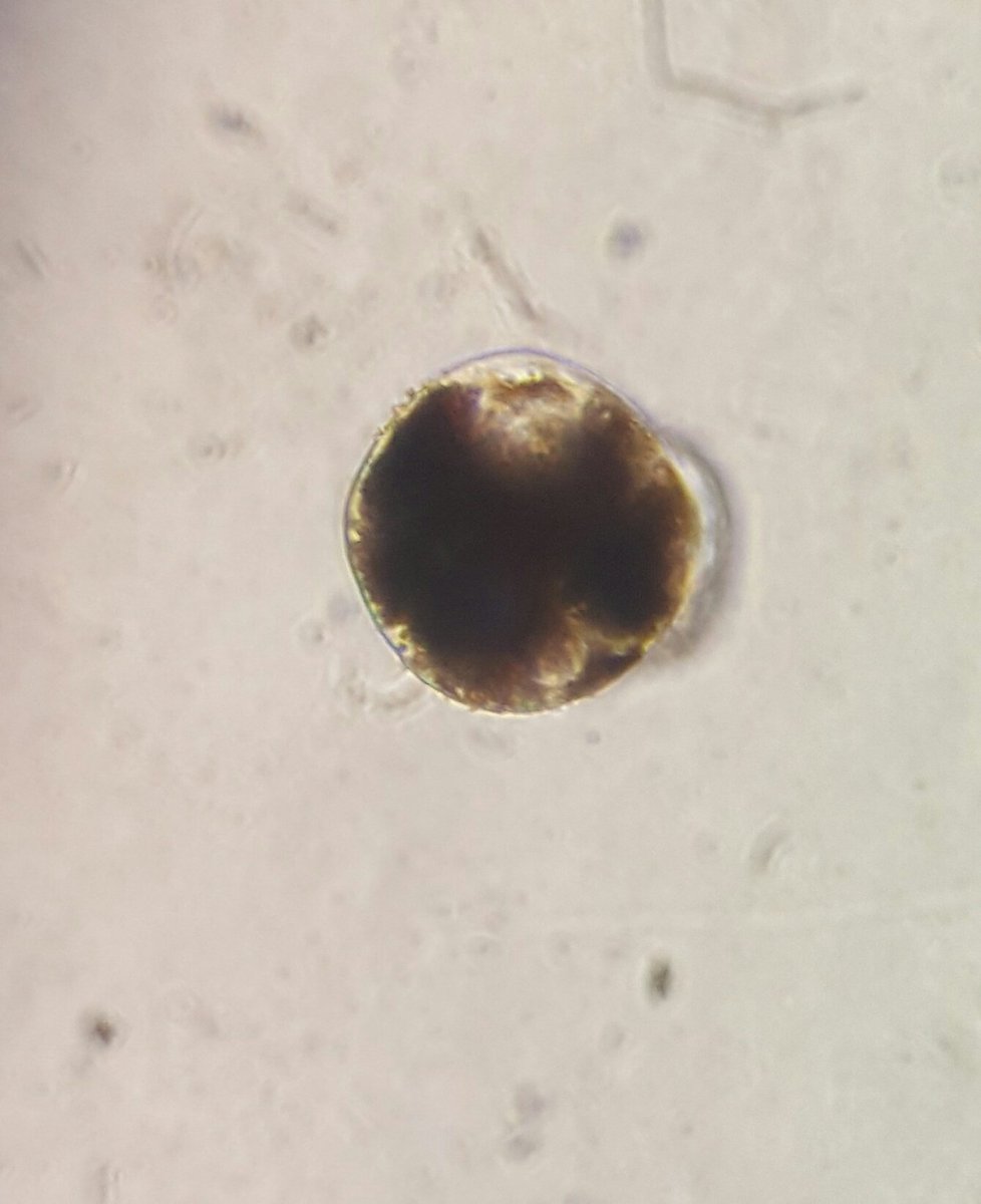 Thepurplelilac's tweet photo. Fresh from my #microscope today: Human retinal #stemcell sphere 
#retina #vision #biology #blindness #regenerativemedicine #UofT @UofTIMS https://t.co/1M32F5z0oj