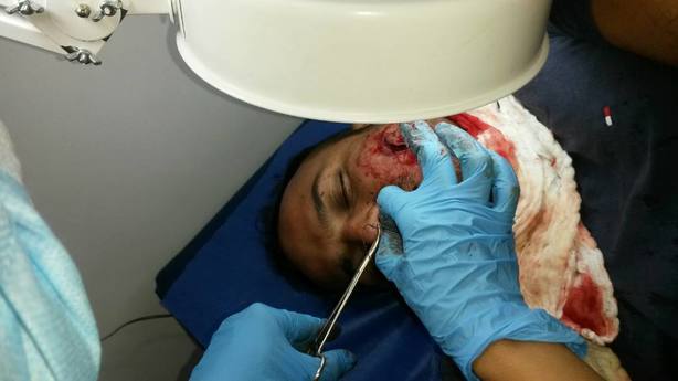 ElNacionalWeb's tweet photo. Más de 50 heridos durante paro cívico en Táchira https://t.co/IKn8jnDSUY  
    https://t.co/ib1RUXKnEk