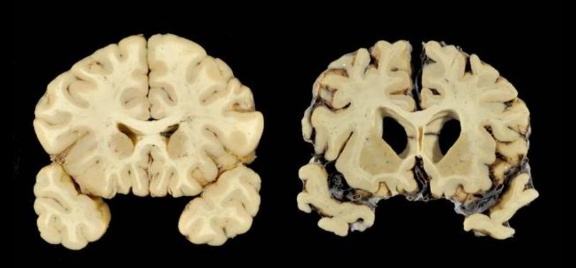 Michael Kalin tweet media