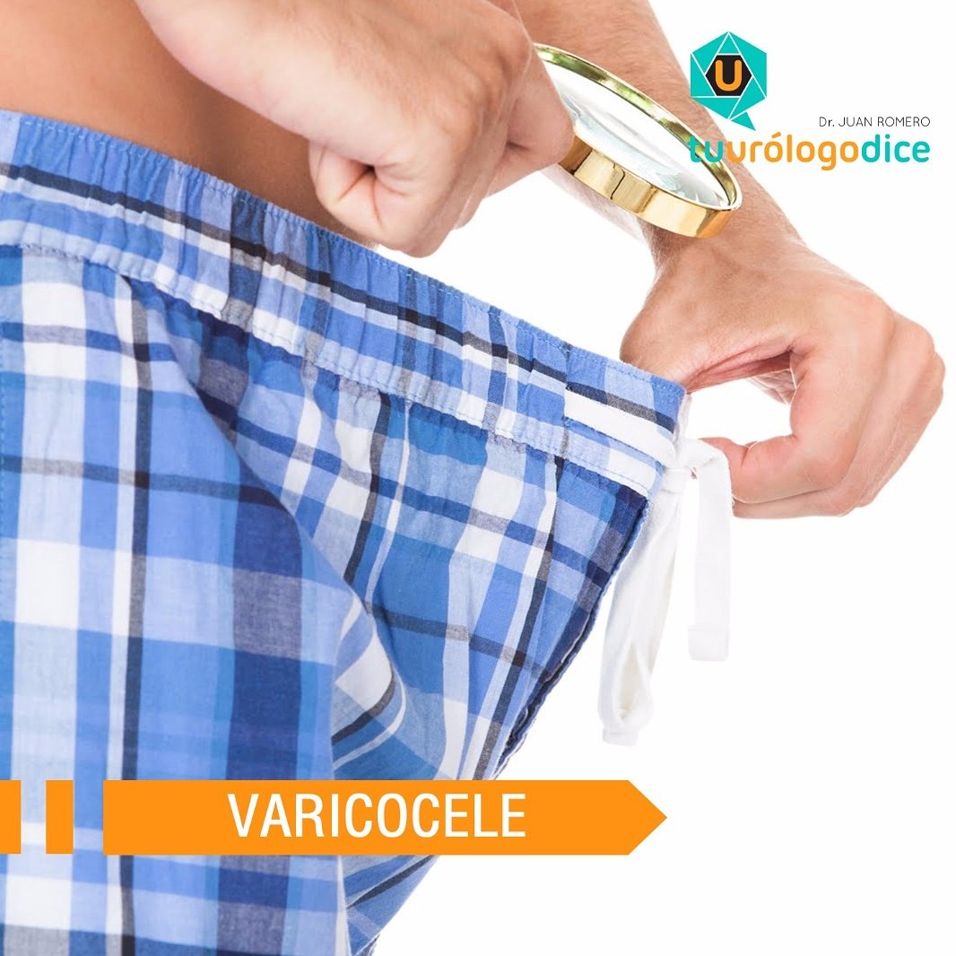 Tuurologodice's tweet photo. Es la dilatación de las venas que drenan la sangre de los testículos,producida por reflujo de la sangre desde la vena renal al testículo. https://t.co/SfJM2zFWgv