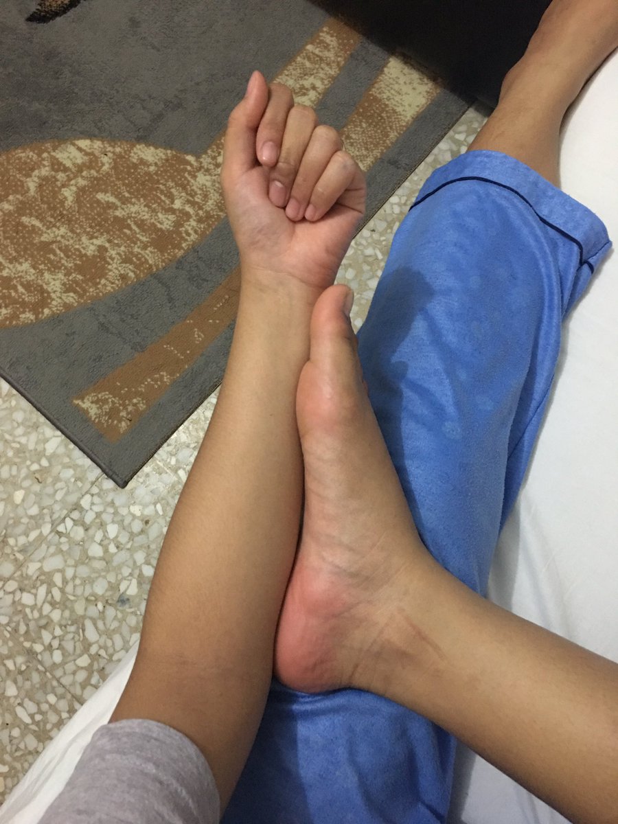 Iambree2x's tweet photo. @Official_Conan once said "The length of one's foot is the same length as the one's forearm".This will probably will save my time then #lmao https://t.co/VIiDNpSVgn