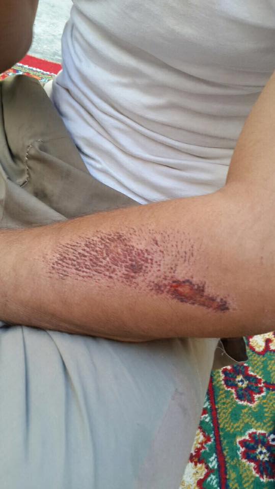 Raqqa_SL's tweet photo. 1-#Raqqa Detainees being tortured in #SDF prisons in #Tabqah city, they were subjected to electric shocks heavy spanking with iron pipes https://t.co/n3YNLGNUyq