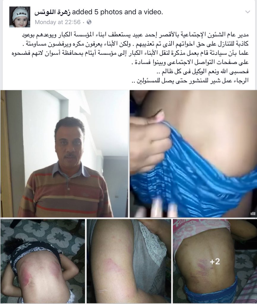 7okaha's tweet photo. وصلوا صوت أيتام الأقصر كل هذه أثار تعذيب علي أجساد الأطفال
أي صحفي ياريت يتواصل معاهم
افضحوا بن الوسخة ده
#ريتويت https://t.co/VBHsvJCCga